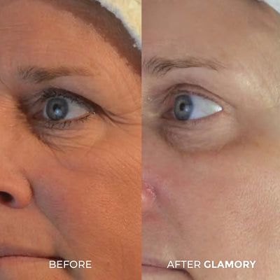 Erae Age-Reverse™ Bio-Infusion