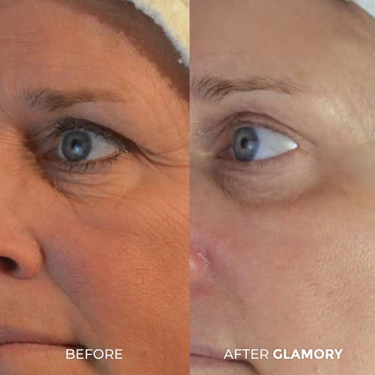 Erae Age-Reverse™ Bio-Infusion