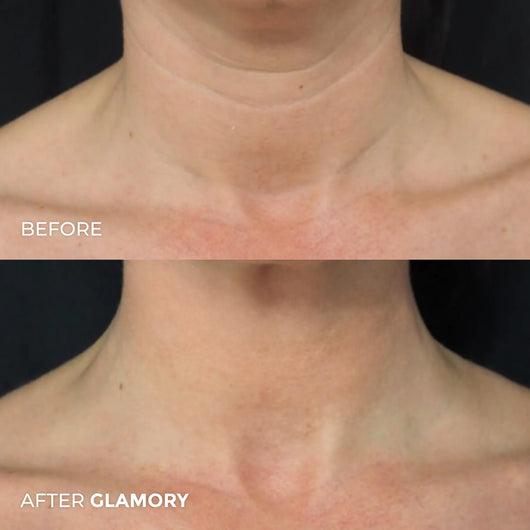 Erae Age-Reverse™ Bio-Infusion