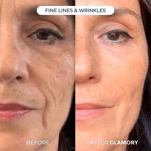 Erae Age-Reverse™ Bio-Infusion